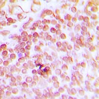ERCC1 Antibody (Internal)