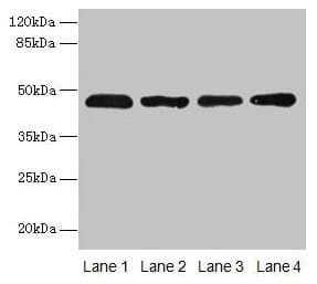 Polyclonal Rabbit anti-Human ZDHHC23 Antibody (IHC, WB)