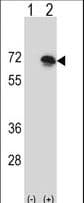 BLNK Antibody (aa57-82)