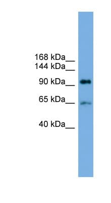 Polyclonal Rabbit anti-Human EXOC6 / SEC15 Antibody (aa287-336, WB)