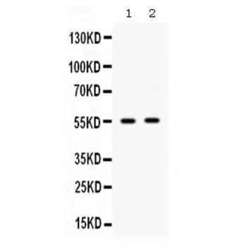 SLC2A9 / GLUT9 Antibody (aa262-297)