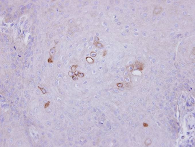 PHKA1 Antibody (aa828-1062)