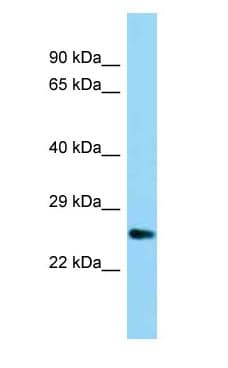 UBTD1 Antibody (C-Terminus)