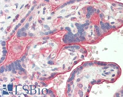 IHC-plus™ CD39 Antibody