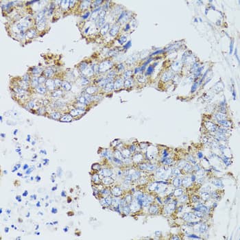 Polyclonal Rabbit anti-Human EGFR Antibody (IHC, IF, WB)