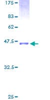 Human NPPA / ANP Protein (Recombinant GST)