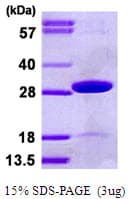 Human TPK1 Protein (Recombinant His)