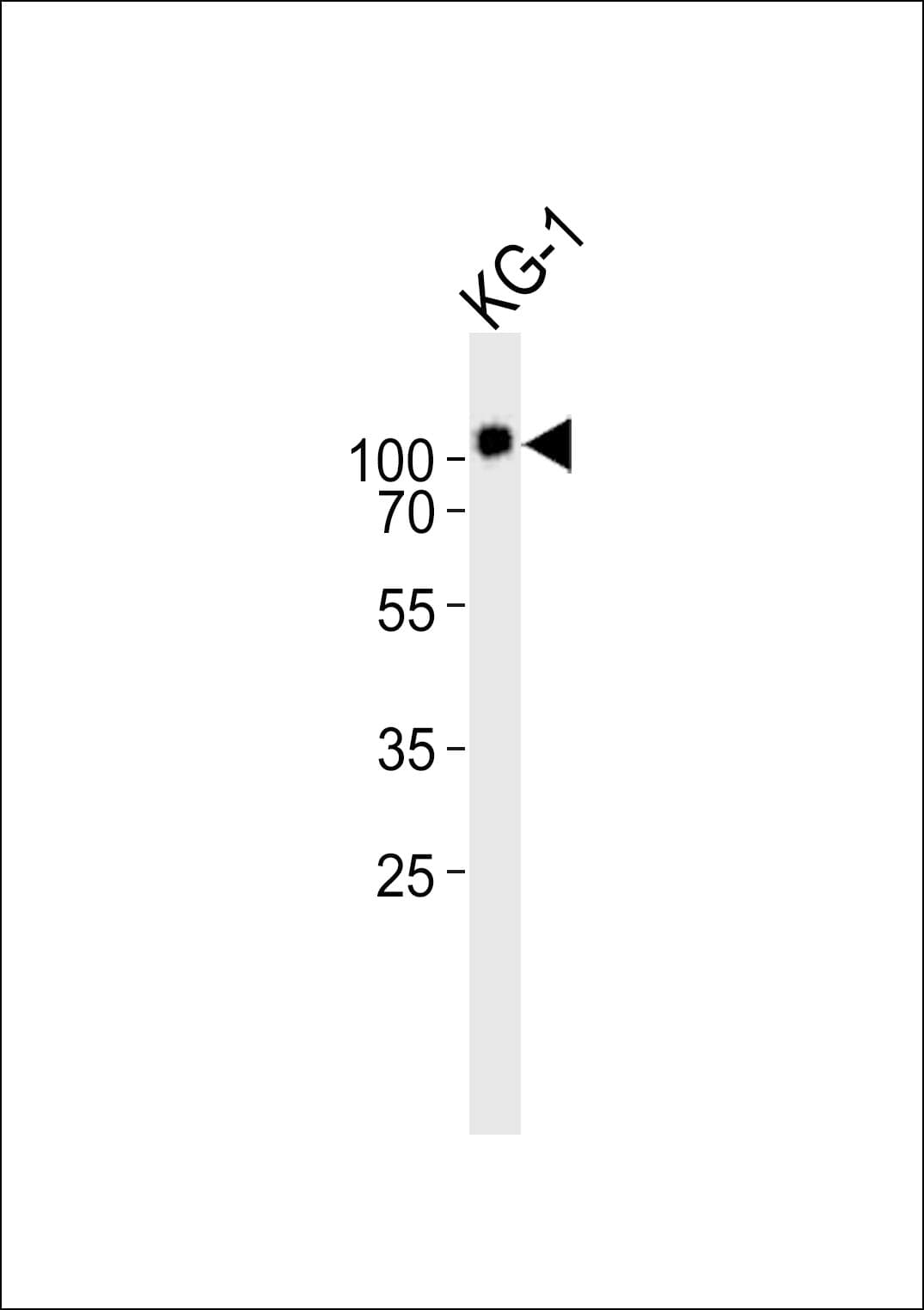 Polyclonal Rabbit anti-Human CD34 Antibody (aa320-354, WB)