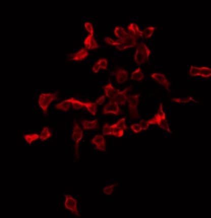 Polyclonal Rabbit anti-Human TMEM145 Antibody (IF, WB)