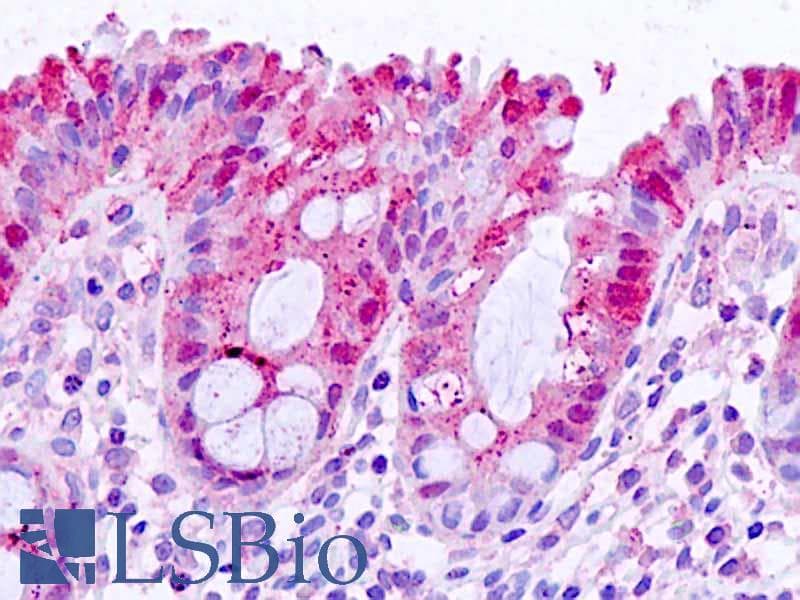 IHC-plus™ LGALS3 / Galectin 3 Antibody (aa155-168)