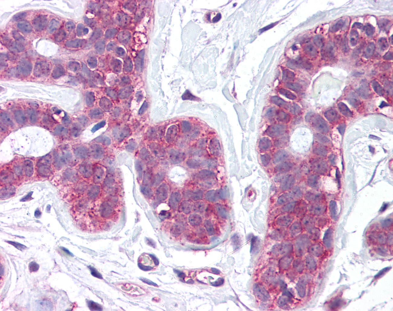 IHC-plus™ SLC39A6 / LIV-1 Antibody (Internal)