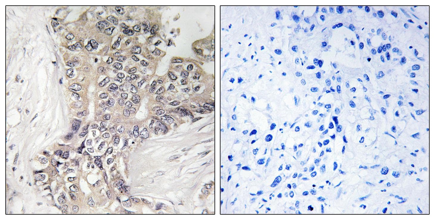 Polyclonal Rabbit anti-Human B3GALTL Antibody (IHC, WB)