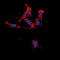 Polyclonal Rabbit anti-Human EPH Receptor B1+B2 Antibody (Internal, IHC, IF, WB)
