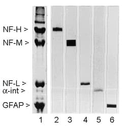 NF-L / NEFL Antibody (clone DA2)