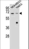 GLMN Antibody (aa498-525)