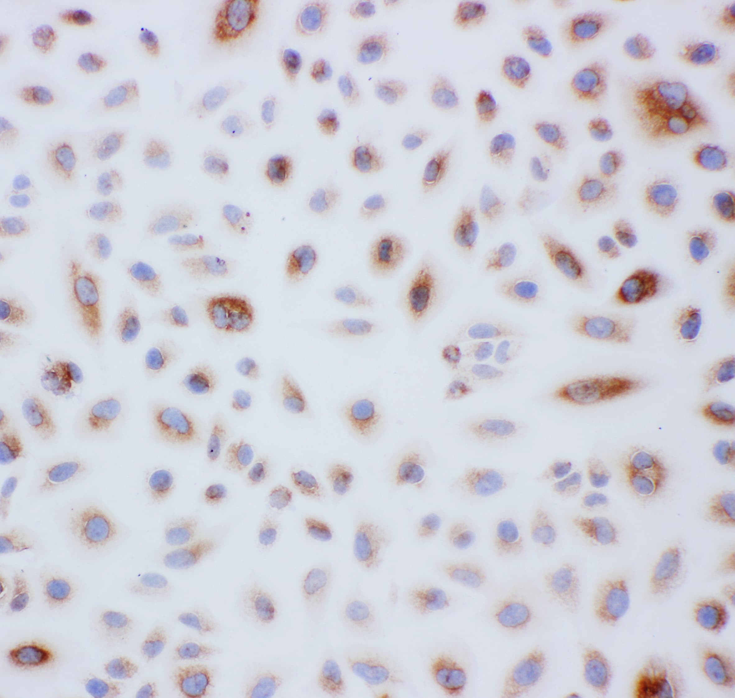 PRDX3 / Peroxiredoxin 3 Antibody (aa240-257)