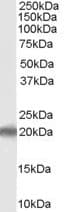 IHC-plus™ Polyclonal Goat anti-Human PERP Antibody (aa172-185, IHC, WB)