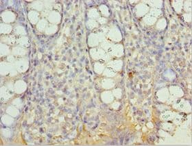 Polyclonal Rabbit anti-Human AIMP2 Antibody (aa141-320, IHC, WB)