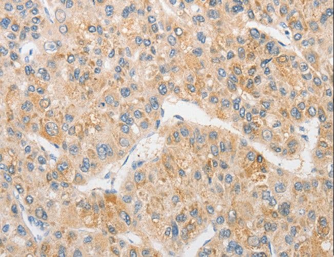 TLR5 Antibody