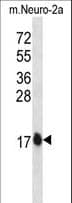 GABARAPL2 / ATG8 Antibody (aa1-28)