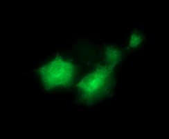 FAK / Focal Adhesion Kinase Antibody (clone OTI4G7)