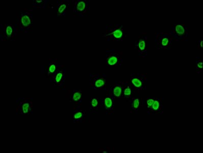 Polyclonal Rabbit anti-Human HIST1H2AI Antibody (IHC, IF)