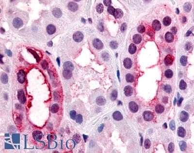 IHC-plus™ V1RL1 / VN1R1 Antibody (Extracellular Domain)