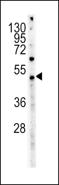 Myc Tag Antibody