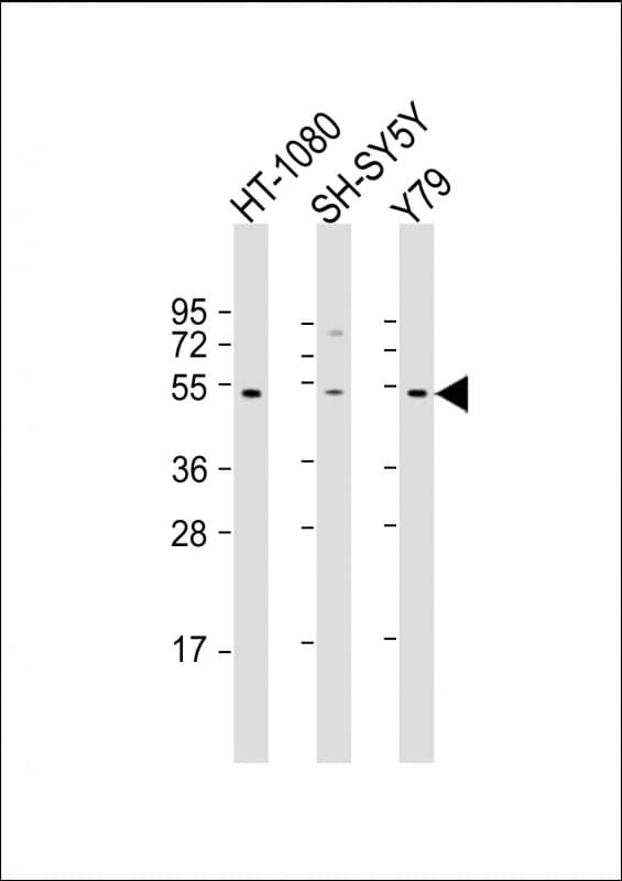 ZNF513 Antibody (aa82-115)