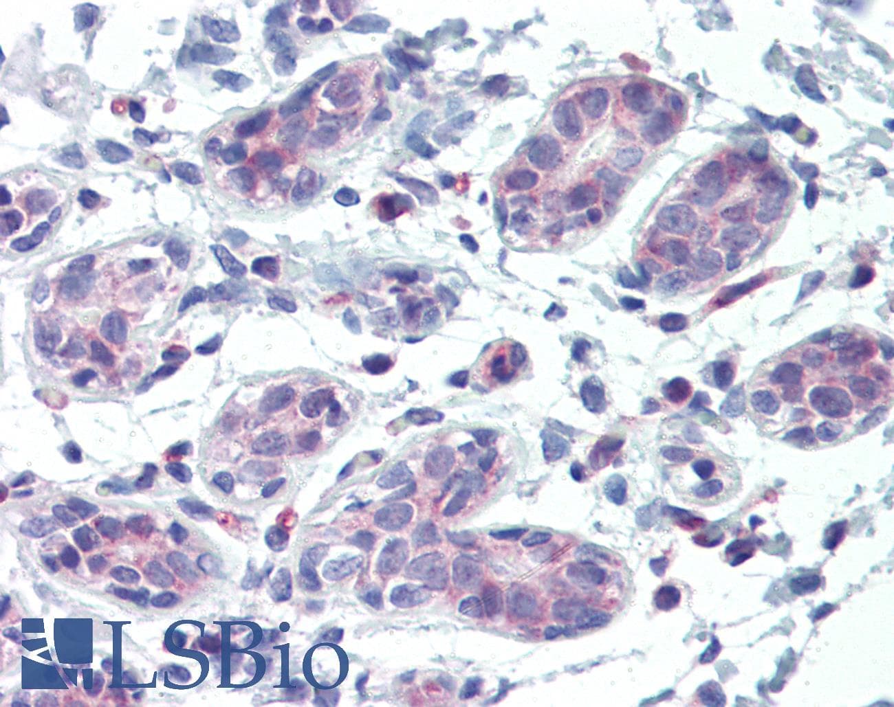 IHC-plus™ Polyclonal Rabbit anti-Human ABCB5 Antibody (aa1-30, IHC, WB)