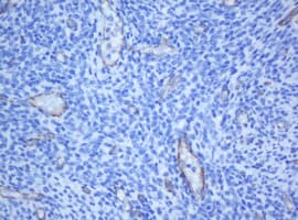 PECAM-1 / CD31 Antibody (clone OTI1F9)