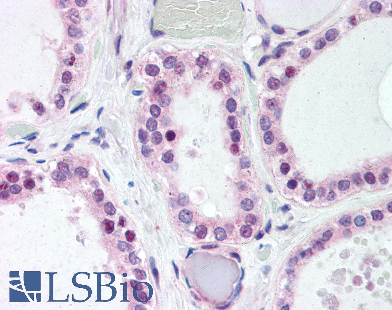 IHC-plus™ WNT4 Antibody (Internal)