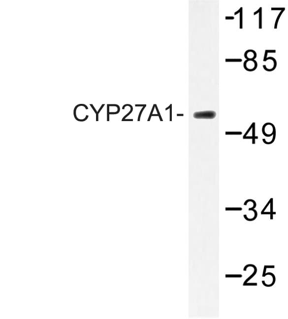 CYP27 / CYP27A1 Antibody (Glu131)