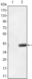 MATN1 / Matrilin 1 Antibody (clone 5A8)