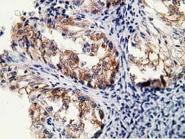 SH2B3 / LNK Antibody (clone OTI2D8)