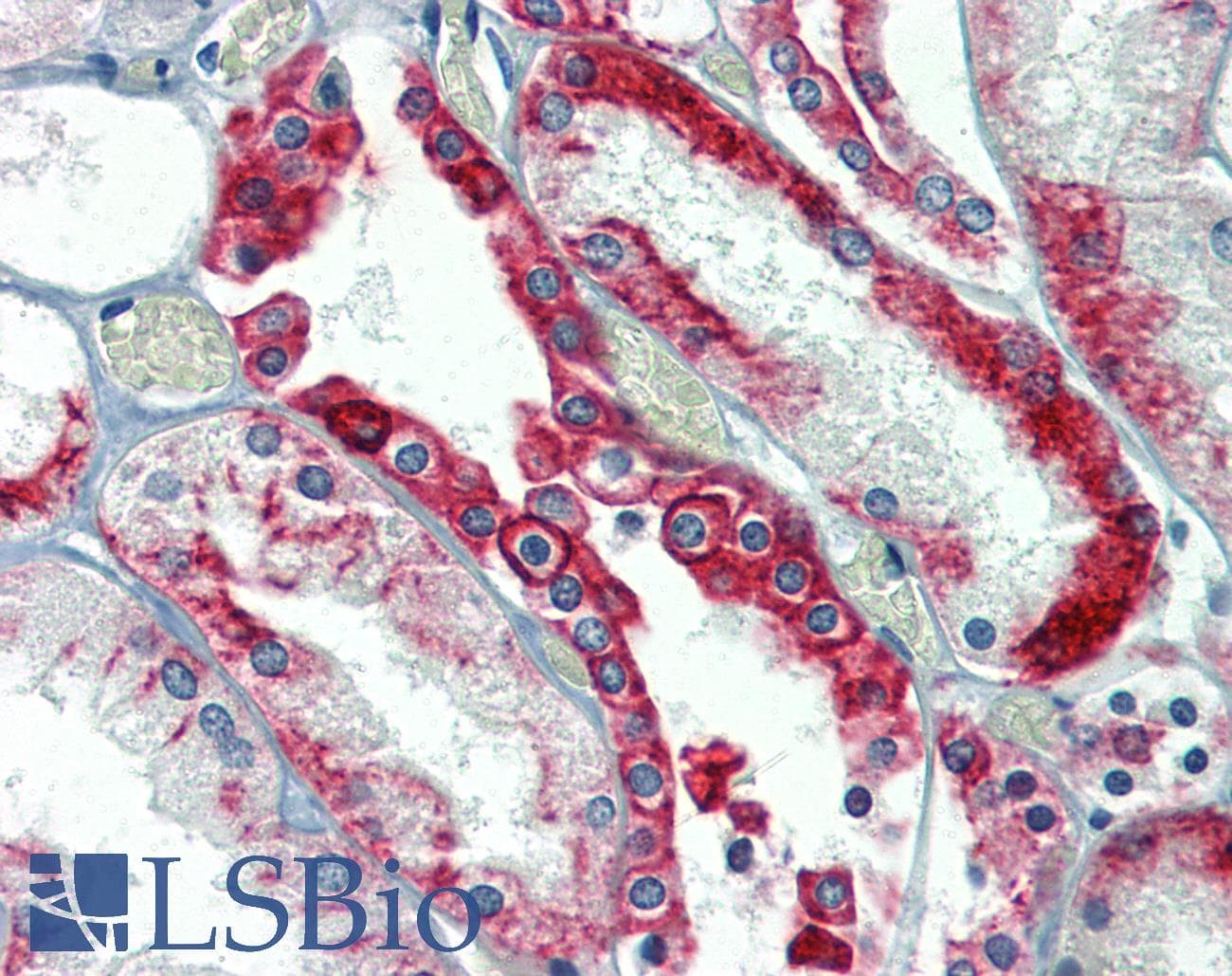PathPlus™ KRT18 / CK18 / Cytokeratin 18 Antibody (clone DA-7)