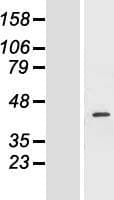 FANCF Protein (Over-Expression Lysate Myc-DDK (Flag))