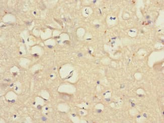 GABRA4 Antibody