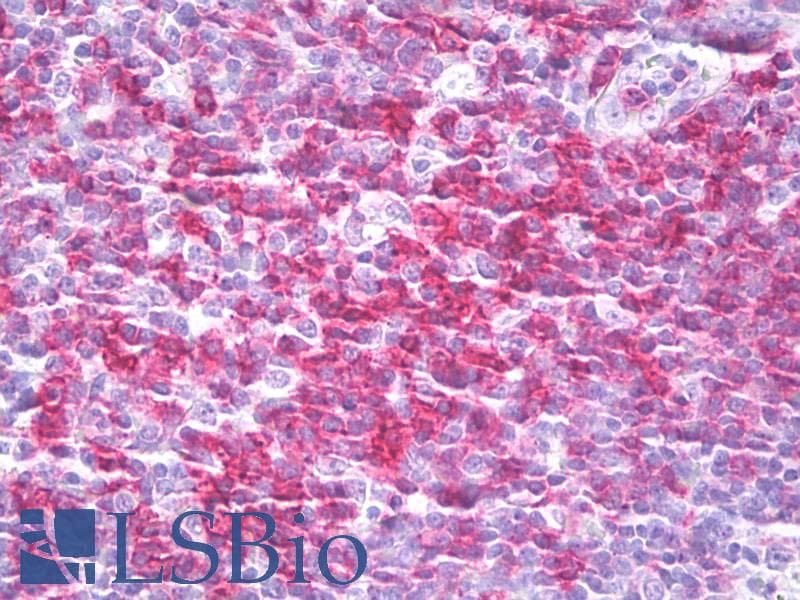 PathPlus™ CD27 Antibody (clone M-T271)