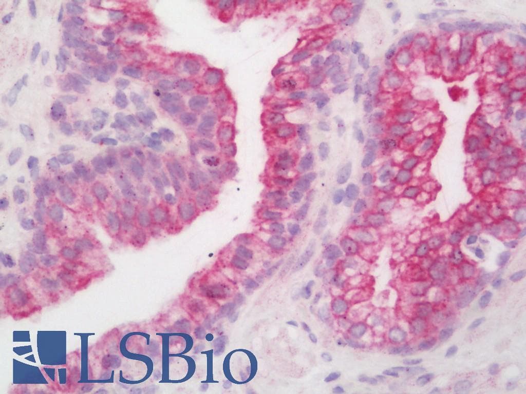 IHC-plus™ SCN4B Antibody (aa61-110)