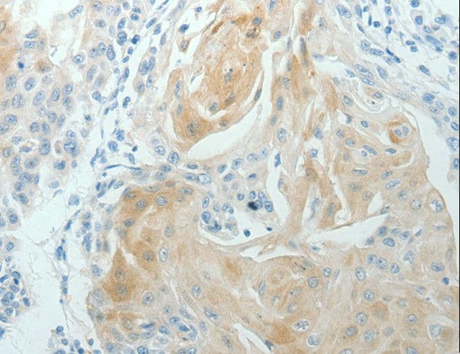 RNF126 Antibody