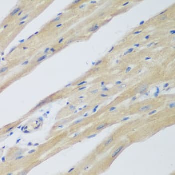 Polyclonal Rabbit anti-Human WDR77 / MEP50 Antibody (IHC, IF, WB)