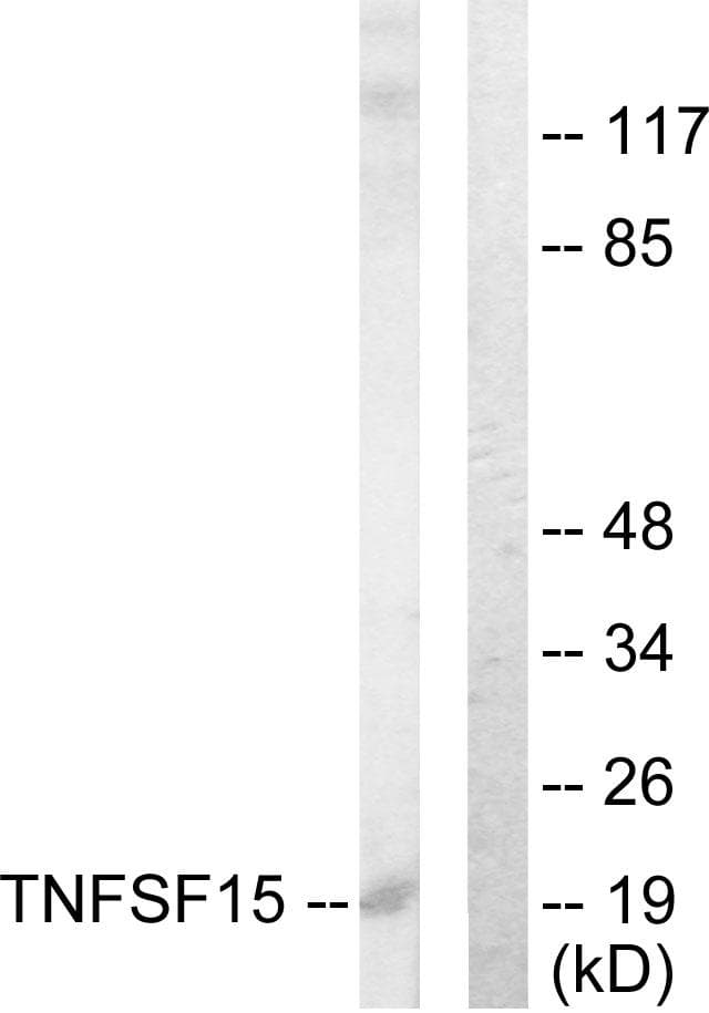 TNFSF15 / TL1A / VEGI Antibody