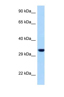 Polyclonal Rabbit anti-Human EMD / Emerin Antibody (aa34-83, WB)