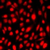 IHC-plus™ NET1 / ARHGEF8 Antibody