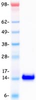 Human SAA2 / Serum Amyloid A2 Protein (Recombinant Myc-DDK (Flag))