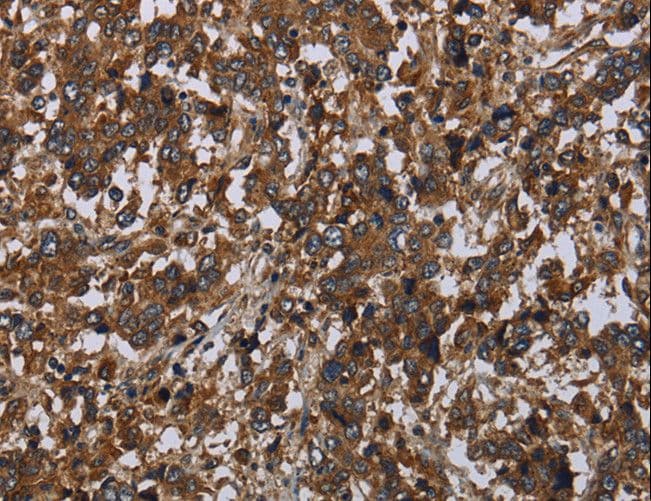Polyclonal Rabbit anti-Human HOMER2 / Homer 2 Antibody (IHC)