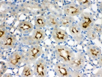Polyclonal Rabbit anti-Human SMC3 / HCAP Antibody (IHC, WB)