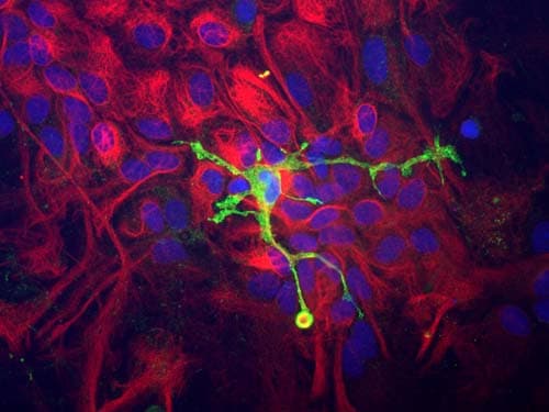 IHC-plus™ CORO1A / Coronin 1a Antibody