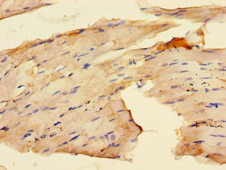 RAB28 Antibody (aa98-218)